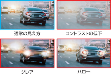 多焦点眼内レンズ（3焦点タイプ）のデメリット・注意点